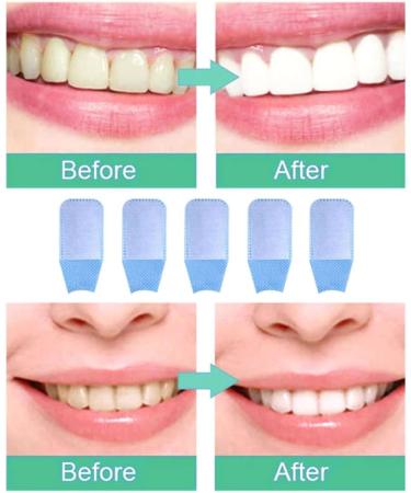 Toothbrush Wipes - 50pcs Oral Hygiene Care Tool for Clean Teeth | Finger Wipe Cleaning - Buy Online on GoSupps.com