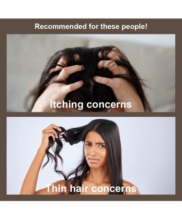 Buy Naisture Red Ginseng 3X Premium Golden Shampoo 24.68oz - Revitalize All Hair Types Soothes Itchy Scalp & Strengthens Thinning Hair - International Shipping Available - Buy Online on GoSupps.com