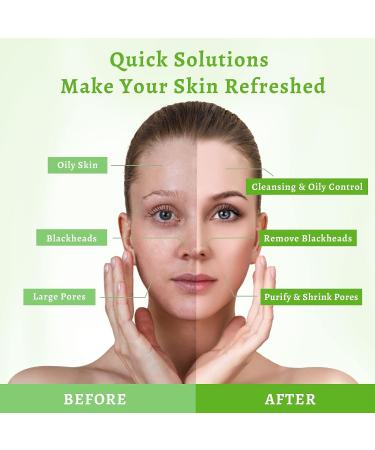 ANAI RUI Green Tea Clay Mask for Poreless Cleanse, Blackhead Remover with Kaolin, Aloe & Collagen - Pore Minimizer, Hydrating Face Mask 4.05OZ - Buy Online on GoSupps.com