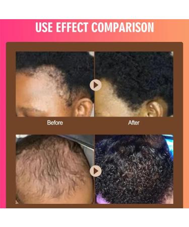 Buy 2.1Oz Pure Batana Oil for Hair & Skin - Natural Treatment for Strength & Resilience - Buy Online on GoSupps.com