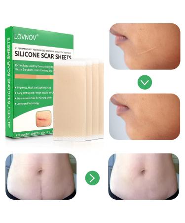 Professional Silicone Scar Removal Sheets - 4 Reusable pcs (Green) - For C-Section Surgery, Burn, Keloid, Acne - Drug-Free Solution - 2 Month Supply - Buy Online on GoSupps.com