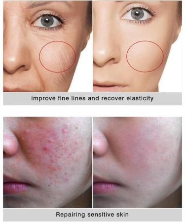 30ml High Dose EGF Serum to Repair Acne & Surgical Scars Wrinkles Burns & Dark Spots - Vegan Microneedling Lifting Anti-Aging Firming Concentrate - Buy Online on GoSupps.com
