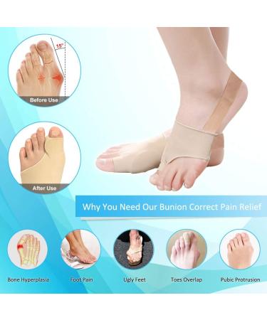 Bunion Corrector & Toe Straightener Pad - Soft Silicone Gel for Pinky Toe Relief | Tailor's Bunion Splint with Anti-Slip Design - Little Toe Separator for Overlapping Toes (Medium) - Buy Online on GoSupps.com