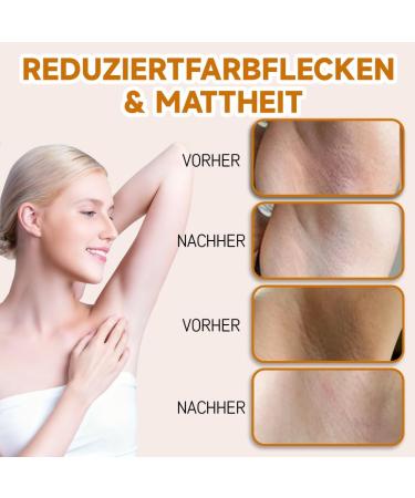 IKOPFLN 2 pieces Armpit Whitening Cream suitable for lightening melanin moisturizing and rejuvenating the skin unisex - Buy Online on GoSupps.com