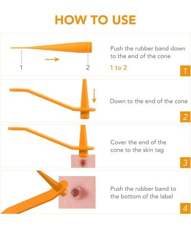 2-IN-1 Skin Tag Tool Kit for Men and Women Fast and Easy Micro Skin Tags Skin Tag Tool Kit for Medium to Large Skin Tags (2mm-7mm) Complete Skin Tag Tool Kit Safe for Most Parts - Buy Online on GoSupps.com