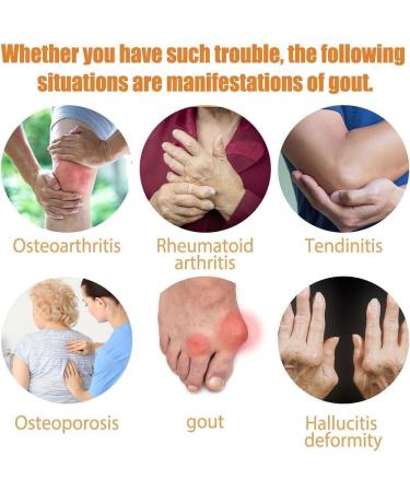 Buy Todahof Bee Venom Joint Spray | Effective Relief | International Shipping Available - Buy Online on GoSupps.com