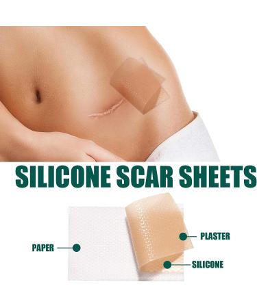 Silicone Scar Sheets Roll - 1.6x60inch | Soft Gel Tape for Scar Removal - Medical Grade, Reusable | C Section, Keloid, Surgery, Burn, Acne - Buy Online on GoSupps.com