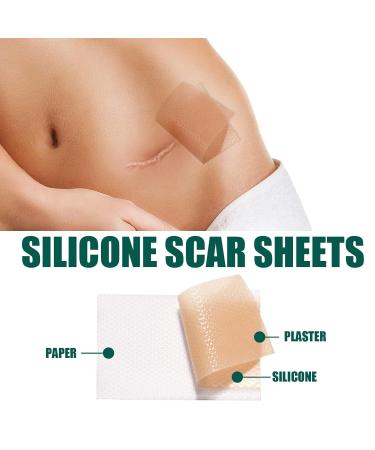 Scar Removal Tape 59.1in Roll | Reduce Hyperplasia & Improve Metabolism for Scars - Buy Online on GoSupps.com