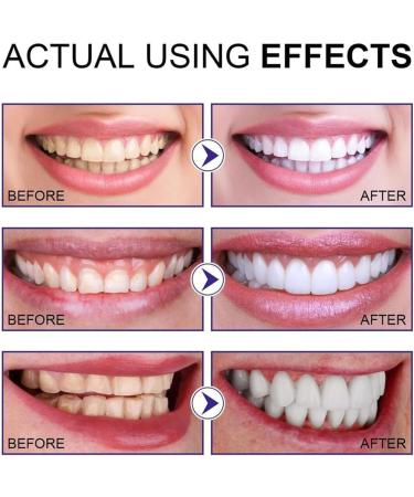 Aiposhiy Teeth Whitening Powder - Natural Mint Tooth Stain Remover & Probiotic Tooth Cleaning Powder (2 Pieces) - Buy Online on GoSupps.com