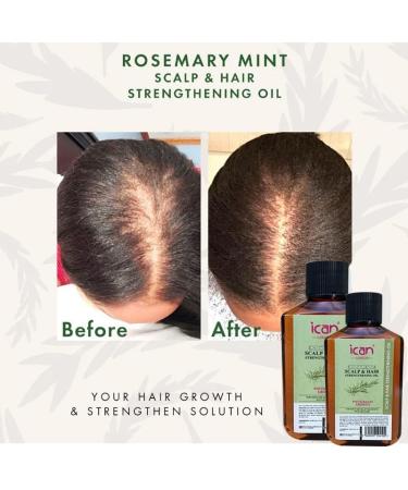ican London Rosemary Mint Scalp & Hair Treatment Oil For Faster Hair Growth 50ml - Buy Online on GoSupps.com