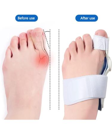 1PC Hallux Valgus Corrector - Bunion Toe Separator for Foot Care & Correction - Buy Online on GoSupps.com