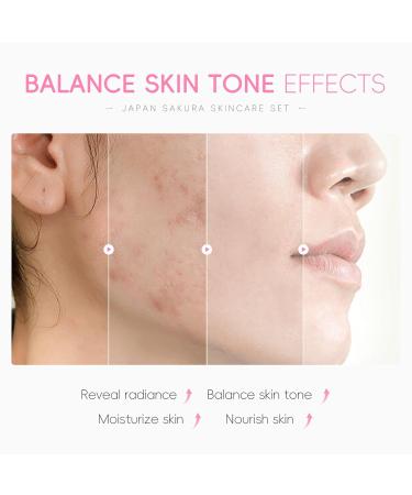 6Pcs Sakura Skincare Kit The Skin Care Set Includes Facial Cleanser Toner Lotion Essence Eye Cream And Face Cream Beauty Skin Care Travel Present Set For Teenage Girls Women - Buy Online on GoSupps.com