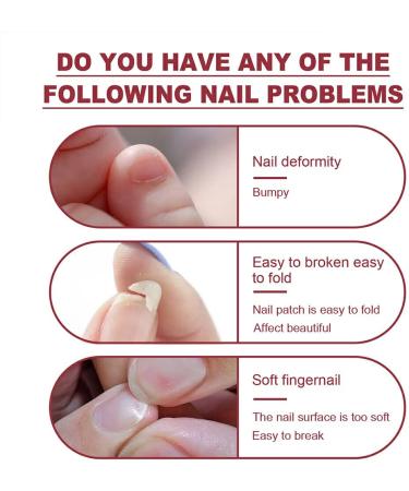 Dajidafu Nails Repairing Extension Gel Portable Fingernail Manicure Pedicure Polish Accessory for Household Professional Salons - Buy Online on GoSupps.com