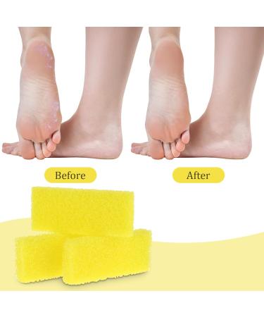 40Pcs Disposable Pumice Stone for Feet Foot Scrubber Sponge Pedicure Foot Callus Remover for Feet Foot Heel Exfoliator Tool Foot Scruber Foot Care Kit for Hard Skin Dead Skin Removal for Feet Repair - Buy Online on GoSupps.com