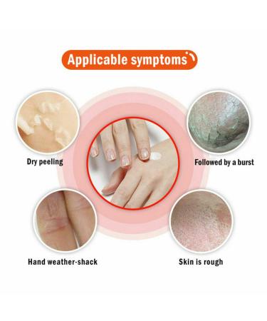 Natural Anti-Cracking Frost Repair Cream for Hands & Feet | Cracked Skin Relief & Regeneration | Winter Skin Care - Buy Online on GoSupps.com