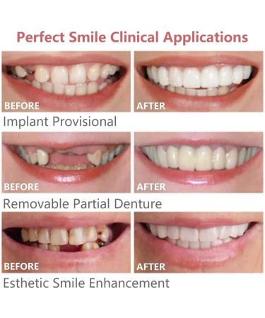 Wttfc Dentures 2 Pairs Cosmetic Dentures Temporary Dentures Upper and Lower Temporary Dentures Quickly Repair Your Teeth and Smile for Men and Women - Buy Online on GoSupps.com