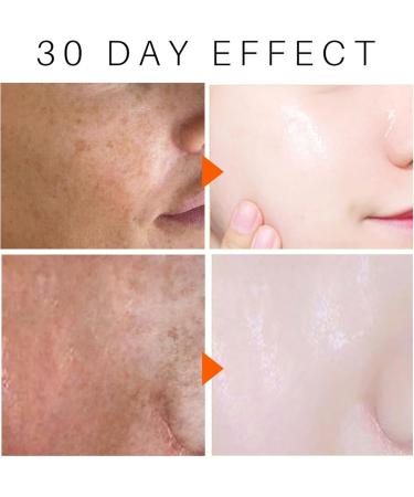 Glutathione Face Moisturizer for Women - Face Cream for women - High Moisturizing Face Moisturiser - Anti Aging Face Cream - Soothing Brightening Reduces Dark Spots Age Spot Even Skin Tone - Buy Online on GoSupps.com