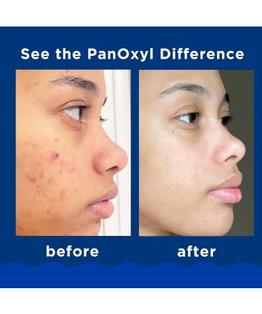  Orgrul 100g foaming facial cleanser gentle facial cleanser facial cleanser facial cleanser face cleanser bha pore oil deep exfoliating deep pore cleansing facial - Buy Online on GoSupps.com