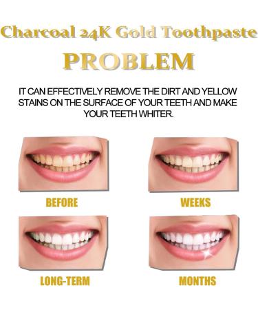 KLYso Activated Charcoal Teeth Whitening Toothpaste | Deep Clean Yellow Stains Freshen Breath & Protect Oral Health(3PCS) - Buy Online on GoSupps.com