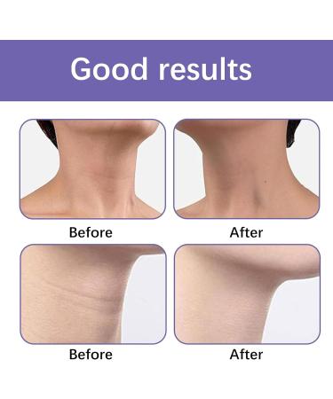 Neck Firming Cream Tighten & Lift Firming Neck Cream Anti Aging Neck Cream Anti Aging Moisturiser for Neck and D colletage Advanced Tightening Moisturizer for Firm Youthful Skin 110ml - Buy Online on GoSupps.com