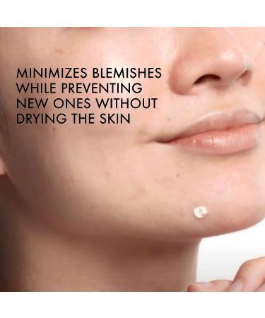 Vichy Normaderm S.O.S Acne Rescue Spot Corrector | Acne Spot Treatment with 10% Sulfur, Niacinamide & Glycolic Acid | Blemish Remover for Sensitive Skin - Buy Online on GoSupps.com