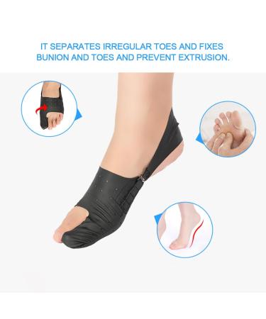 Anggrek Hallux Valgus Corrector - Bunion Relief & Toe Separator for Men & Women | Optimize Comfort & Alignment - Buy Online on GoSupps.com