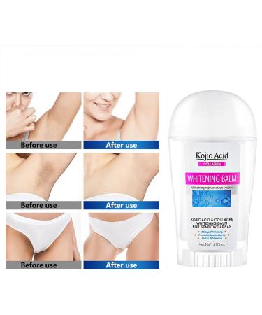 Kojic Acid Whitening Cream for Intimate Areas Whitening Cream for Intimate Areas Whitening Cream for Dark Spots for Neck Armpit Elbow Inner Cream - Buy Online on GoSupps.com