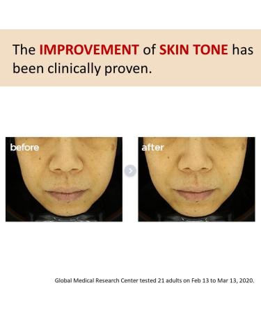 Make p:rem Poncirus Trifoliata C Dark Spot Serum | Skin Clearing & Uneven Tone Treatment | Vitamin C Face Serum | 40ml - Shop Internationally - Buy Online on GoSupps.com