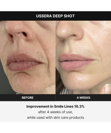 Medicube Age-R USSERA - Advanced Anti-Aging Device - Buy Online on GoSupps.com