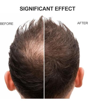 Hair Building Fibers Hair Building Fibres Powder Hair Fibres Dark Brown Hair Fibres For Thinning Hair Hair Loss Concealer Fiber Hair Building Fibres & Hair Fibers (Dark Brown) - Buy Online on GoSupps.com