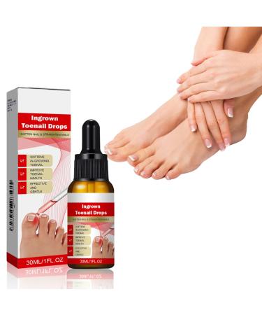 30ml Ingrown Toenail Treatment Drop Natural Ingrown Toenail Correction Oil Cuticle Care Oils for Toe Fungal Nail Treatment Trimming Nail Softening Drop Extra Strong for Damaged Nails