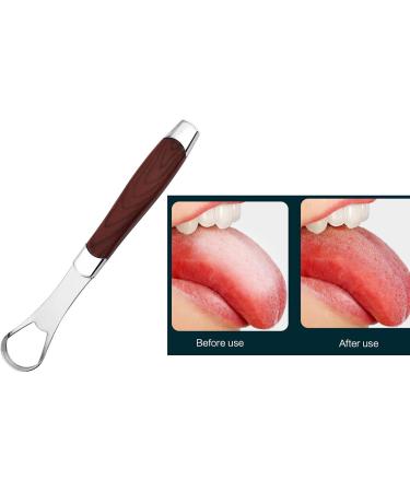 Mialle Metal Tongue Scraper - Effective Bad Breath Cleaner for Adults & Kids | Improve Oral Hygiene - Buy Online on GoSupps.com