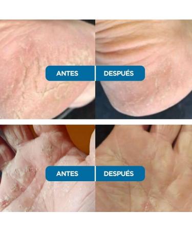 AOKlabs Or Africain Mains et Pieds 50ml | Cr me R paratrice Intensive | Aide Apaiser les Peaux S ches et Irrit es | Hydratation Profonde - Buy Online on GoSupps.com