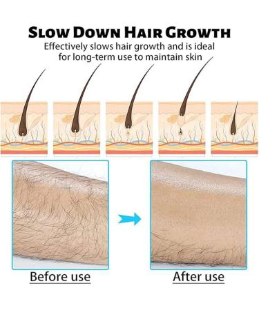 lmoikesz Highly Effective Hair Gums Easy and Gentle on Skin Safe Crystal Hair Remover Stone Crystal Hair Gum Versatile Dusty Blue - Buy Online on GoSupps.com