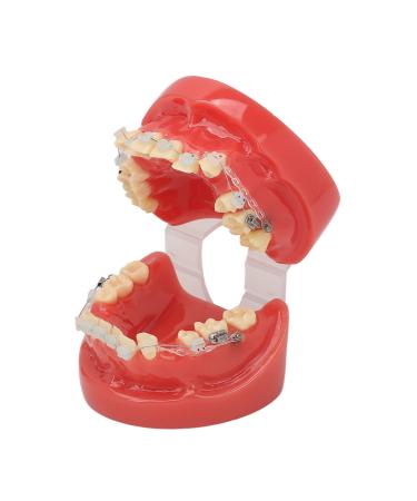 Orthodontic ceramic demonstration model with wires and bracket (24 teeth)-demonstrate overcrowded teeth painting jaw opening
