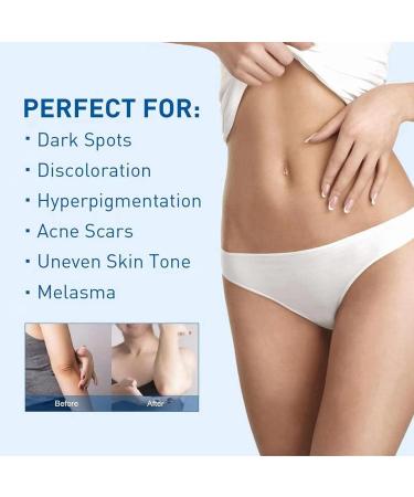 UnderarmCream For Dark Skin And Private Parts Armpit Lightening Cream Body Cream Dark Armpit Treatment Skin Lightening Cream Armpit Brightienng Body Brightening Cream For Dark Skin - Buy Online on GoSupps.com