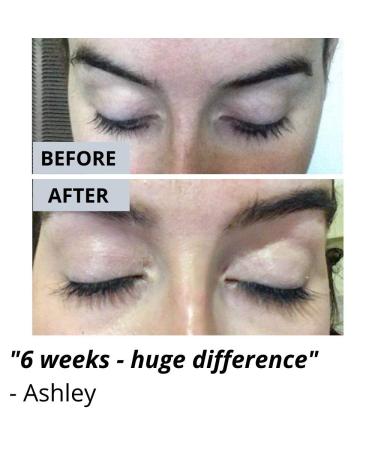 Vera Botanics Lash & Brow Booster Serum for Longer Fuller Eyelashes & Eyebrows - Bestselling Natural Enhancer for Growth & Regrowth - Buy Online on GoSupps.com