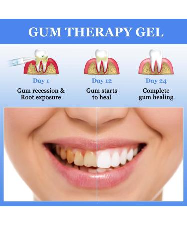 BSOON Gums Therapy Gel - 3 Tooth Whitening Pins & Gum Shield | Teeth Whitening Essence for Stain Removal - Buy Online on GoSupps.com