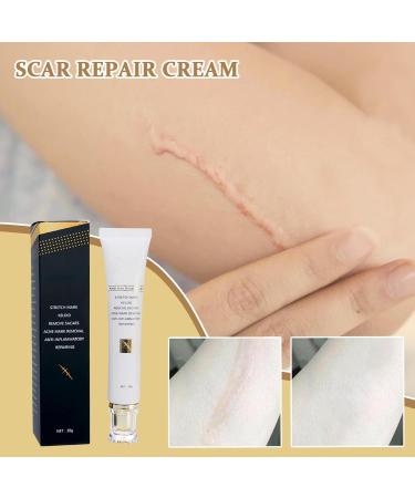  G n rique Body Scar Cream | 30g Non-Greasy Moisturizer - Smoothing Cream for Skin and Scars for Cheeks Arms Hands Neck Teenagers Adults Women Men and Seniors - Buy Online on GoSupps.com