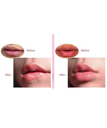 DeliSoul Pink Crystal Lip Masks - 20 Piece Collagen Lip Pads for Hydrating, Plumping, and Anti-Aging - Buy Online on GoSupps.com