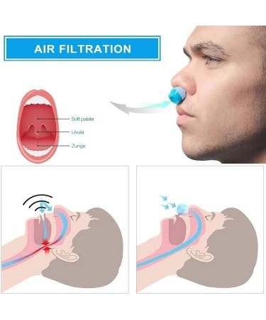Electric Anti-Snoring Device with 3 Gear Wind Adjustment & Fixing Strap - Snore Stopper for Men and Women (White) - Buy Online on GoSupps.com