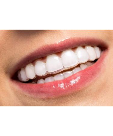 Yishang Customized Up Top Dental Guard - Durable and Soft Mouth Guard for Grinding Teeth Clenching Jaw and Tooth Pain Relief - Buy Online on GoSupps.com