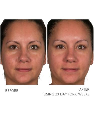Serious Skincare A Defiance Retinol Pads - Daily Facial Treatment with Vitamin A - Micro-Exfoliating Pre-Soaked Discs with Sugar Cane and Algae Extract - 120 Pads (2 Pack) - Buy Online on GoSupps.com