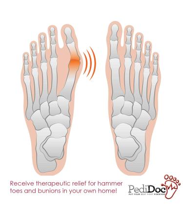 Bunion Corrector & Toe Straightener for Bunion Relief | Restores Natural Toe Alignment, Spacer & Stretcher Included - Buy Online on GoSupps.com