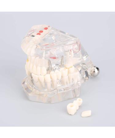 Teeth Model for Dental Teaching & Research | Realistic Adult Teeth Demonstration | No Brand - Buy Online on GoSupps.com