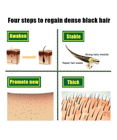 Ginger Hair Growth Germinal Oil 30ML (3pcs) - Regrow Hair in 7 Days | Nourishing Serum for Hair Roots - Buy Online on GoSupps.com