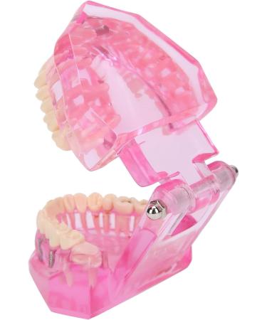 Dentalmodell f r Erwachsene - Klar Zahnmodell f r Studium & Unterricht | Internationaler Versand - Buy Online on GoSupps.com