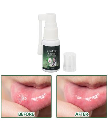 Herbal Oral Spray for Pain Relief | Natural Daily Care | 40ml Soothing Treatment - Buy Online on GoSupps.com