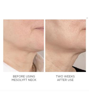 Power Combo Neck & Eye Roller - Brightening Anti-Aging Face Serums & Best Lip Plumper for Multi-Purpose Skin Care - Buy Online on GoSupps.com