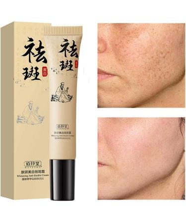 XUEJIAN Face Whitening Freckle Lightening Cream Remove Pigment Acne Spot Melasma Melanin Dark Spots Moisturizing Cream Skin Care - Buy Online on GoSupps.com